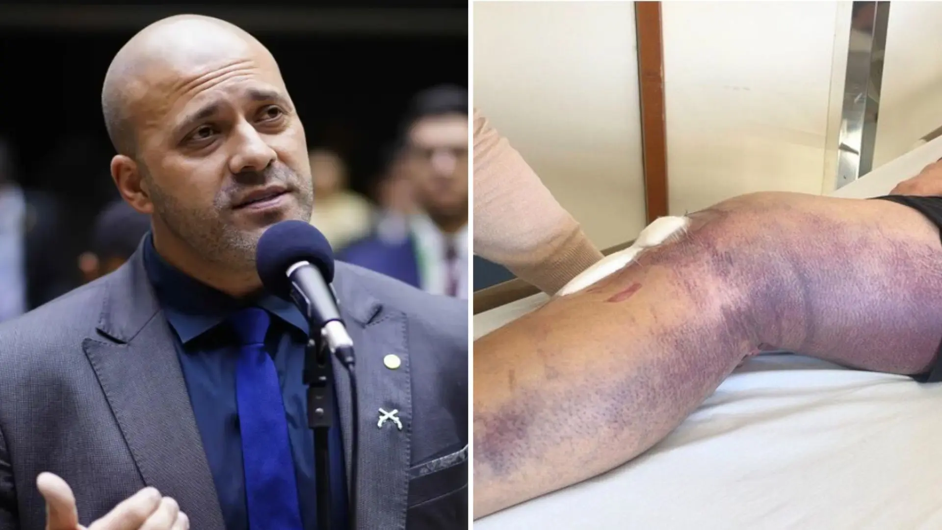PGR apoia saída temporária de Daniel Silveira para fisioterapia em clínica particular 4 PGR apoia saída temporária de Daniel Silveira para fisioterapia em clínica particular - Imagem do artigo original