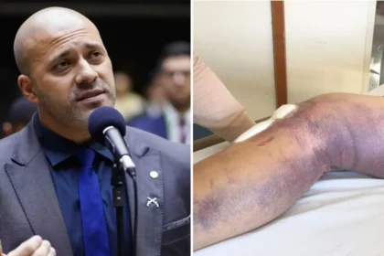 PGR apoia saída temporária de Daniel Silveira para fisioterapia em clínica particular 24 rss featured 15721 1754429268