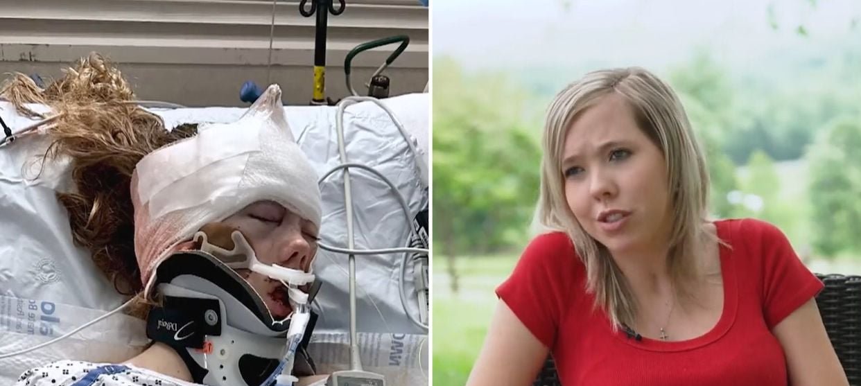 Jovem supera traumatismo craniano após colisão causada por motorista embriagado nos EUA 4 Jovem supera traumatismo craniano após colisão causada por motorista embriagado nos EUA - Imagem do artigo