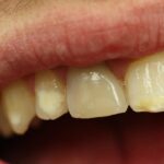 Células-tronco são identificadas como chave para reconstruir dentes e ossos da mandíbula 4 ocrente 1760501877