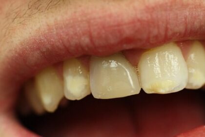 Células-tronco são identificadas como chave para reconstruir dentes e ossos da mandíbula 2 ocrente 1760501877