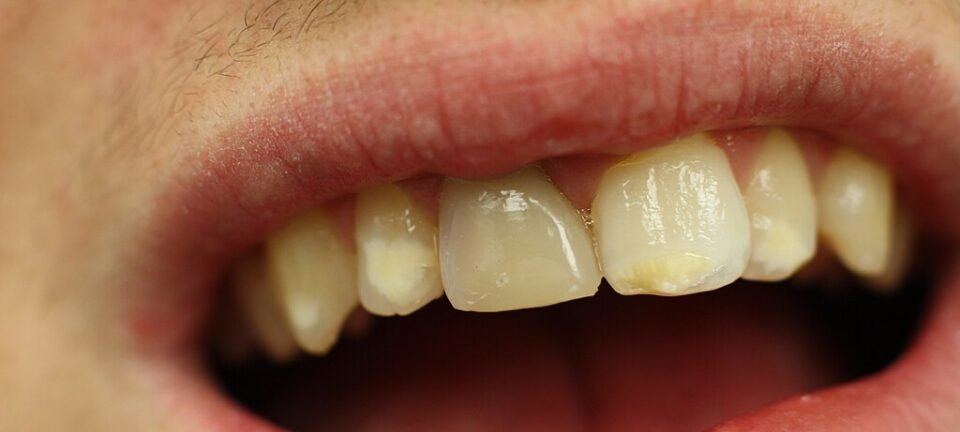 Células-tronco são identificadas como chave para reconstruir dentes e ossos da mandíbula 2 ocrente 1760501877