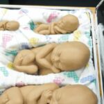 Câmara aprova urgência para projeto que anula norma do Conanda sobre aborto em menores de 14 anos 5 ocrente 1762377441