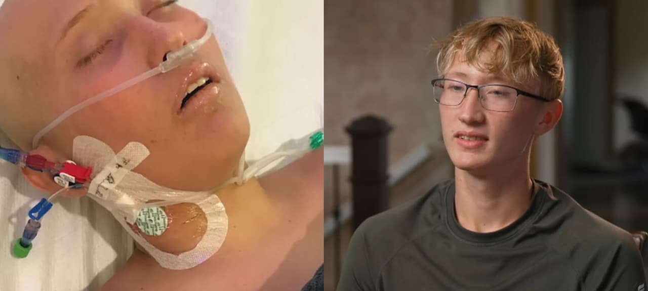 Após dois anos de tratamento, adolescente vence leucemia e tumor cerebral nos EUA 2 ocrente 1762957018