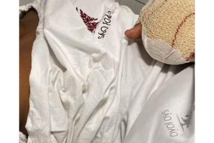 Menino brasileiro de 9 anos perde dois dedos após colegas fecharem porta em escola de Portugal 18 ocrente 1763226116