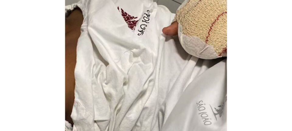 Menino brasileiro de 9 anos perde dois dedos após colegas fecharem porta em escola de Portugal 2 ocrente 1763226116