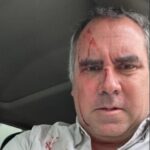 Tiroteio contra carro de candidato peruano abala pré-campanha eleitoral 5 ocrente 1764699599
