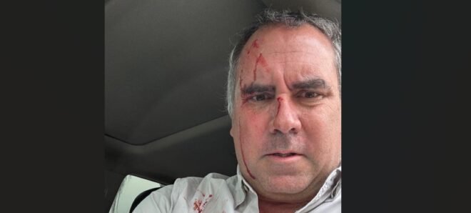 Tiroteio contra carro de candidato peruano abala pré-campanha eleitoral 2 ocrente 1764699599