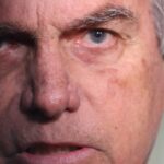 Médicos confirmam estabilidade de Bolsonaro e preveem alta para 1º de janeiro 5 ocrente 1767043155