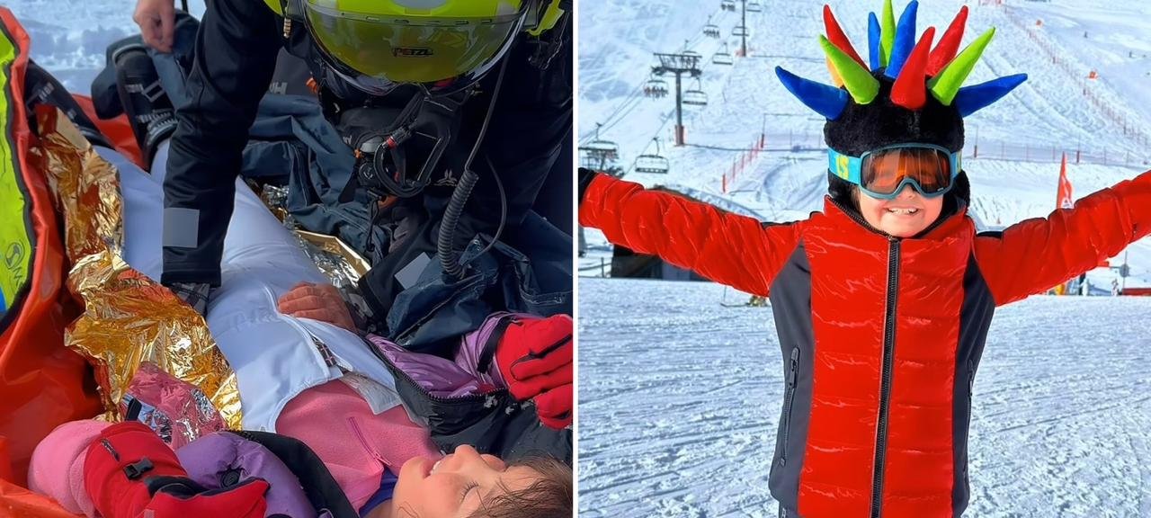 Pais dizem ter presenciado “milagre” após menina recuperar movimento de perna fraturada nos Alpes 2 ocrente 1769845772