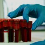 Cães farejam câncer agressivo em 70% das amostras de sangue, aponta estudo nos EUA 5 ocrente 1770485675