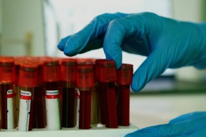 Cães farejam câncer agressivo em 70% das amostras de sangue, aponta estudo nos EUA 6 ocrente 1770485675