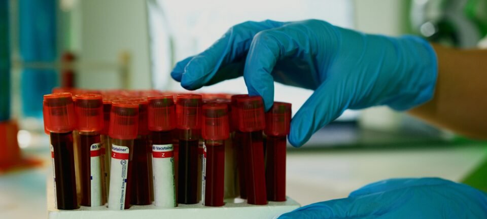 Cães farejam câncer agressivo em 70% das amostras de sangue, aponta estudo nos EUA 2 ocrente 1770485675