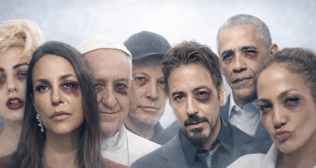 Teoria do “Clube do Olho Roxo” ganha força após hematoma de Ivete Sangalo 2 ocrente 1772718567