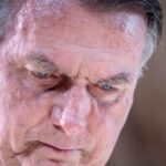 Bolsonaro é internado na UTI com broncopneumonia após passar mal em batalhão da PM 5 ocrente 1773507894