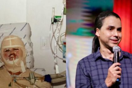 Pastor desperta após 20 dias de coma e supera queimaduras em 40% do corpo 18 ocrente 1773875962
