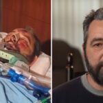 Atropelado a 113 km/h, norte-americano sobrevive a 25 cirurgias e volta a andar um ano depois 4 ocrente 1774414166