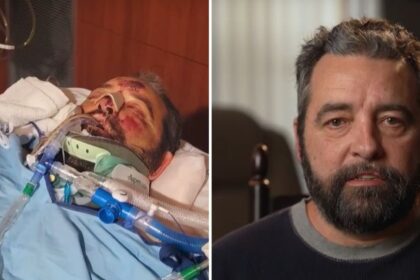 Atropelado a 113 km/h, norte-americano sobrevive a 25 cirurgias e volta a andar um ano depois 6 ocrente 1774414166