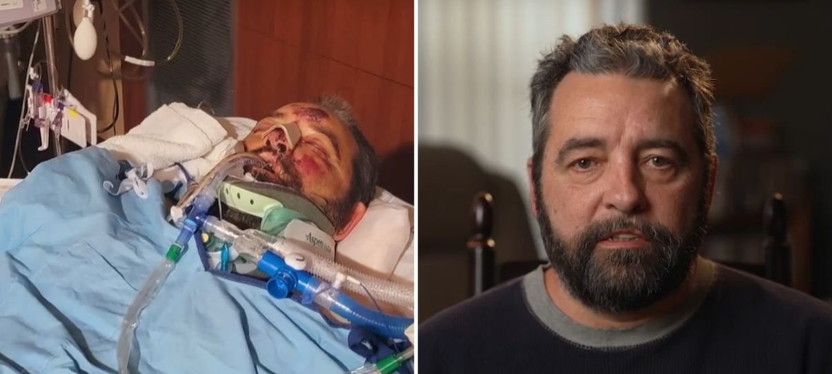 Atropelado a 113 km/h, norte-americano sobrevive a 25 cirurgias e volta a andar um ano depois 2 ocrente 1774414166