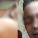 Menino gaúcho desperta de coma e diz ter visto Deus: “Ele me chamou de milagre” 4 ocrente 1776131378