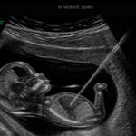 Resolução do CFM que barra assistolia fetal domina sabatina de Messias e aguarda julgamento no STF 4 ocrente 1777939472