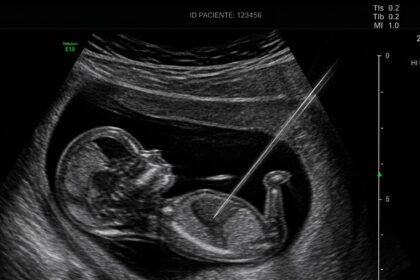 Resolução do CFM que barra assistolia fetal domina sabatina de Messias e aguarda julgamento no STF 6 ocrente 1777939472