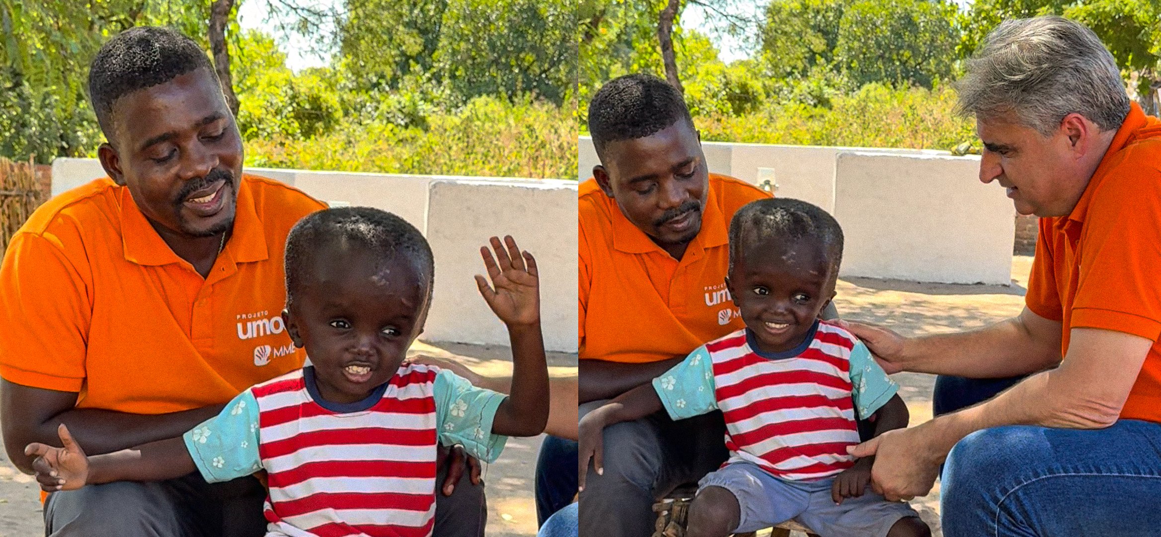 Fé de menino de 5 anos com má-formação emociona equipe missionária no Malawi 2 ocrente 1778597360