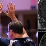 Exames confirmam desaparecimento de tumor cerebral após cultos de oração na Holanda 5 ocrente 1781338751