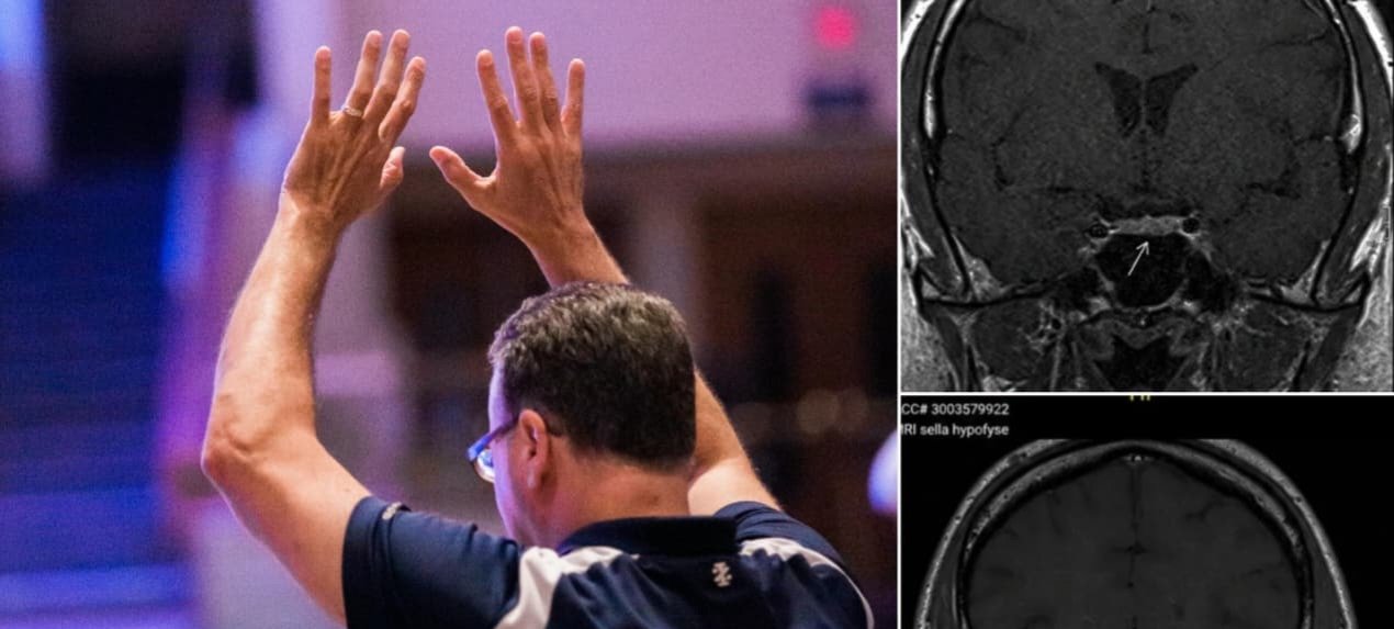 Exames confirmam desaparecimento de tumor cerebral após cultos de oração na Holanda 2 ocrente 1781338751