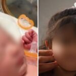 Bebê vence hidropsia fetal e nasce saudável após prognóstico de 2% de sobrevivência 4 ocrente 1783459168