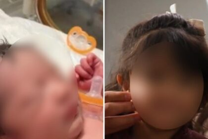Bebê vence hidropsia fetal e nasce saudável após prognóstico de 2% de sobrevivência 20 ocrente 1783459168