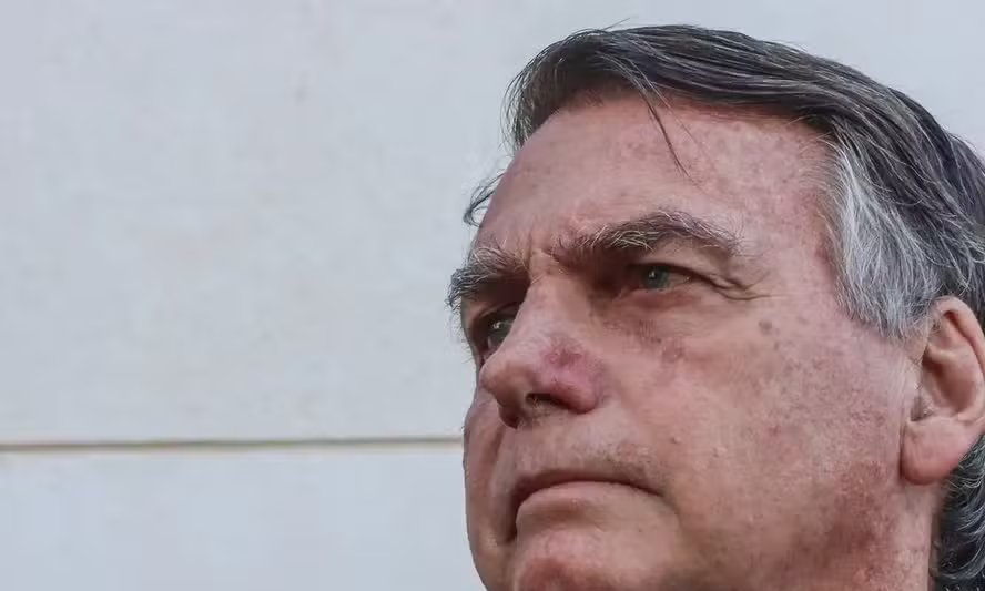 Bolsonaro apresenta crise de soluços por 36 horas e permanece sob observação médica 2 ocrente 1784420643