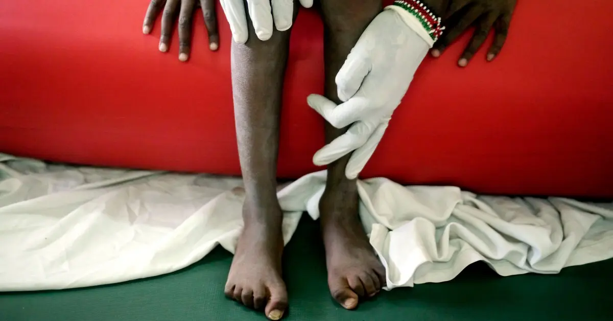Cristãos Africanos Defendem a Dignidade de Adolescentes com Doenças Terminais 1 africa terminally ill children